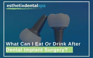What Can I Eat Or Drink After Dental Implant Surgery?