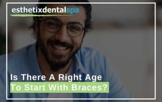Is There A Right Age To Start With Braces?