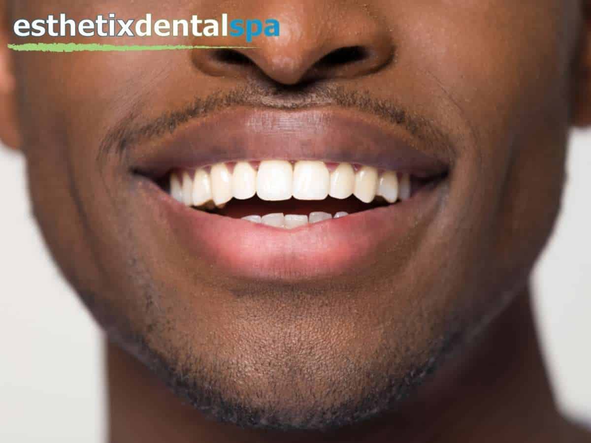 Man smiling after successful orthodontic treatment at a Washington Heights Dental Office