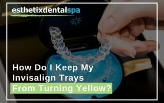 Keeping a Invisalign from turning yellow in Washington
