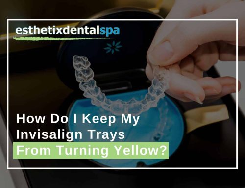 How Do I Keep My Invisalign Trays From Turning Yellow?