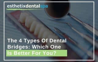 The 4 Types Of Dental Bridges Which One Is Better For You