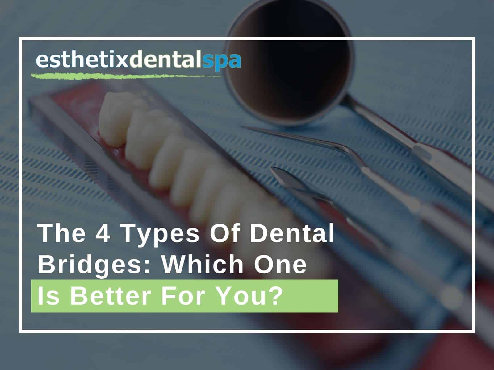 The 4 Types Of Dental Bridges Which One Is Better For You