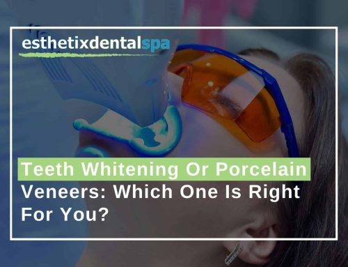 Teeth Whitening Or Porcelain Veneers: Which One Is Right For You?