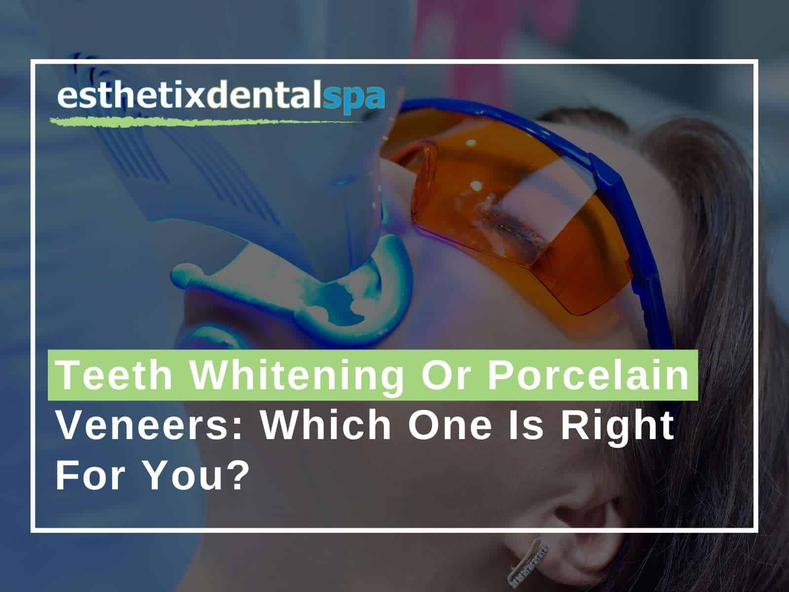 eeth-Whitening-Or-Porcelain-Veneers-Which-One-Is-Right-For-You
