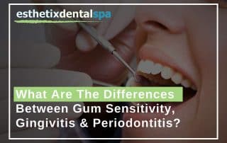 Treating gingivitis in Washington Heights, NY