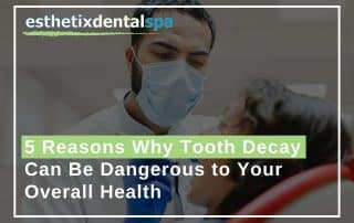 Treating tooth decay with a dentist in Washington Heights