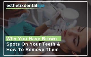 A Washington Heights dentist removing brown spots on teeths