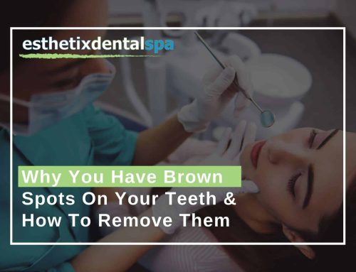 Why You Have Brown Spots On Your Teeth & How To Remove Them