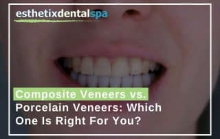 Composite Veneers vs. Porcelain Veneers Which One Is Right For You