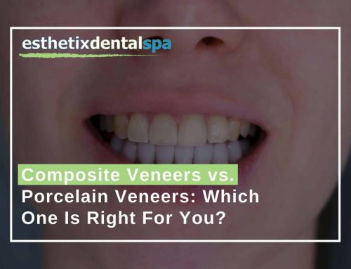 Composite Veneers vs. Porcelain Veneers: Which One Is Right For You?