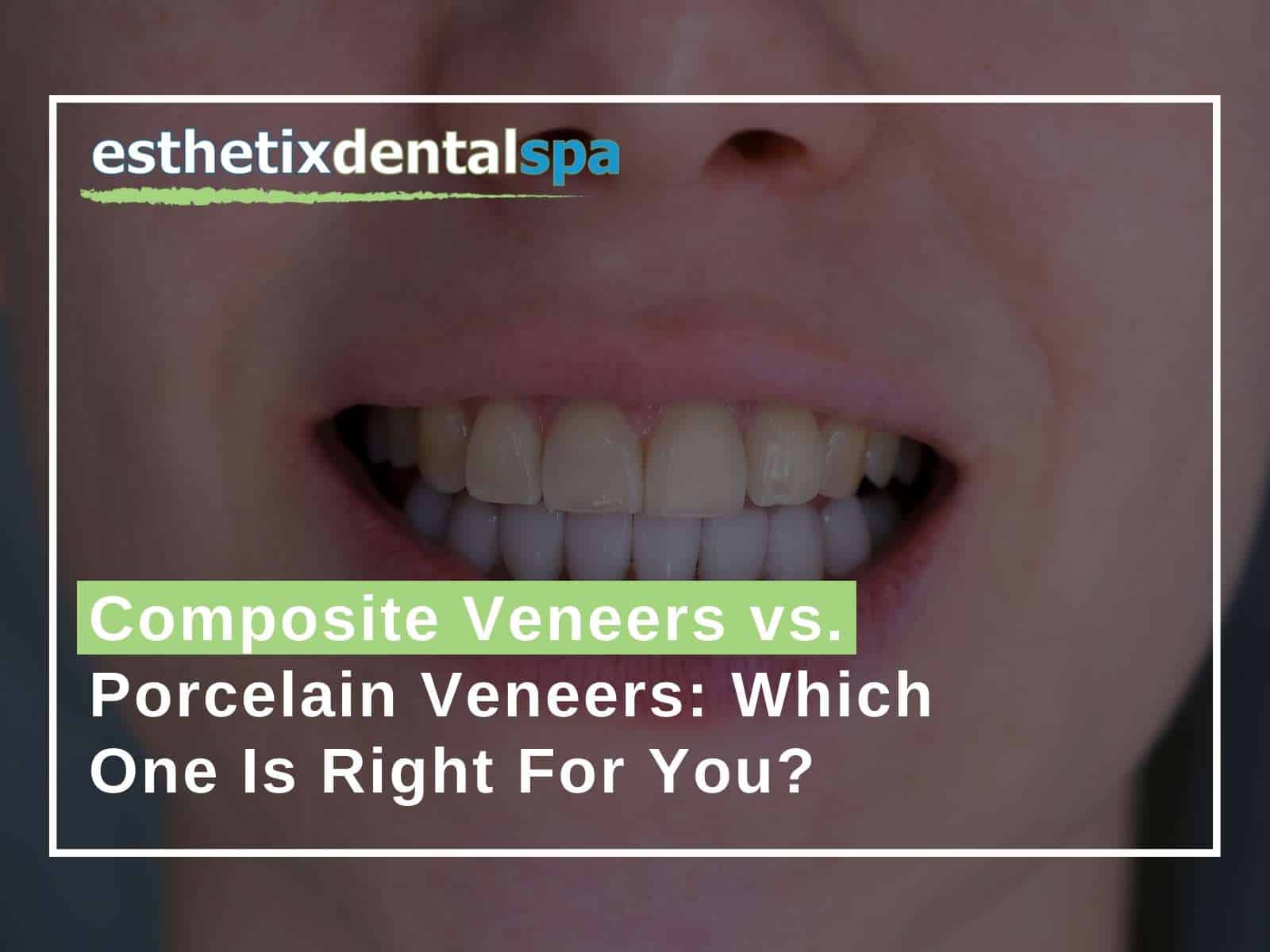 Composite Veneers vs. Porcelain Veneers Which One Is Right For You