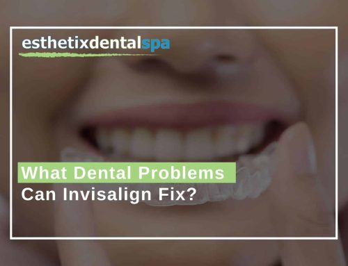 What Dental Problems Can Invisalign Fix?