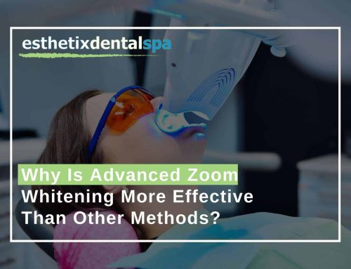 Why Is Advanced Zoom Whitening More Effective Than Other Methods?