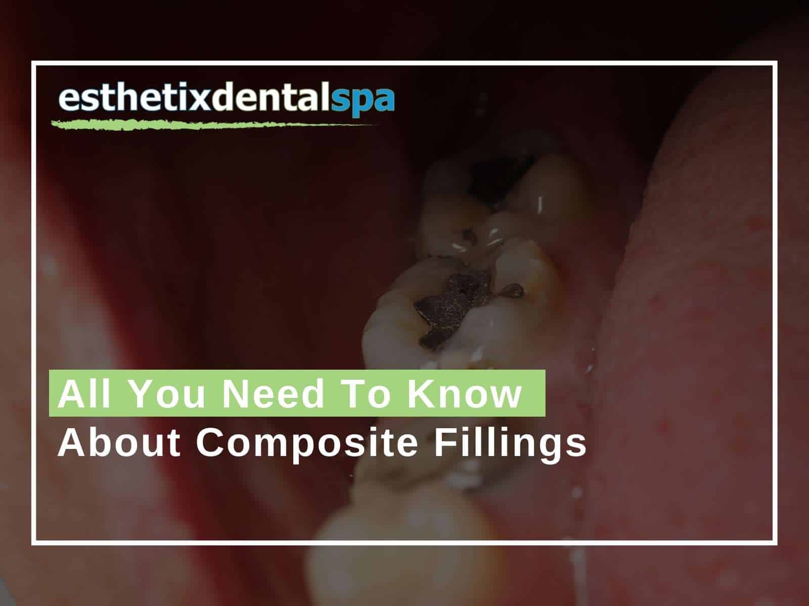 All You Need To Know About Composite Fillings