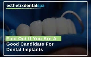 Find Out If You Are A Good Candidate For Dental Implants