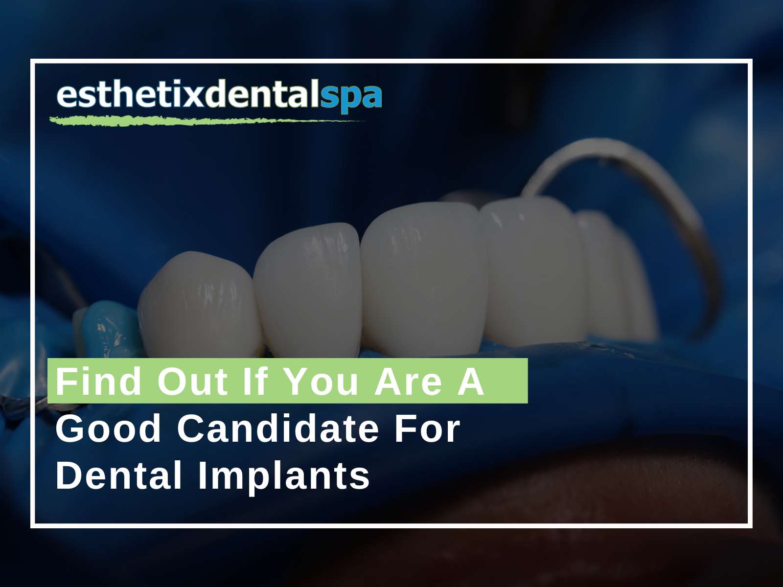 Find Out If You Are A Good Candidate For Dental Implants