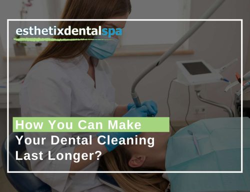 How You Can Make Your Dental Cleaning Last Longer?