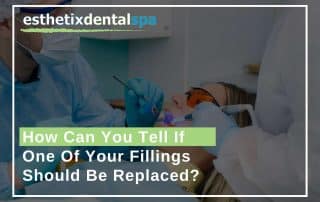 How Can You Tell If One Of Your Fillings Should Be Replaced