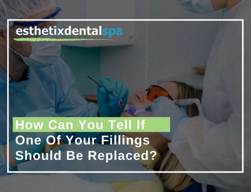 How Can You Tell If One Of Your Fillings Should Be Replaced?