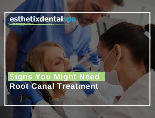 Signs You Might Need Root Canal Treatment