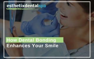 How Dental Bonding Enhances Your Smile