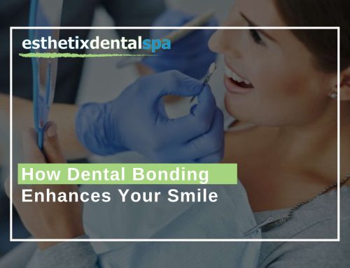 How Dental Bonding Enhances Your Smile