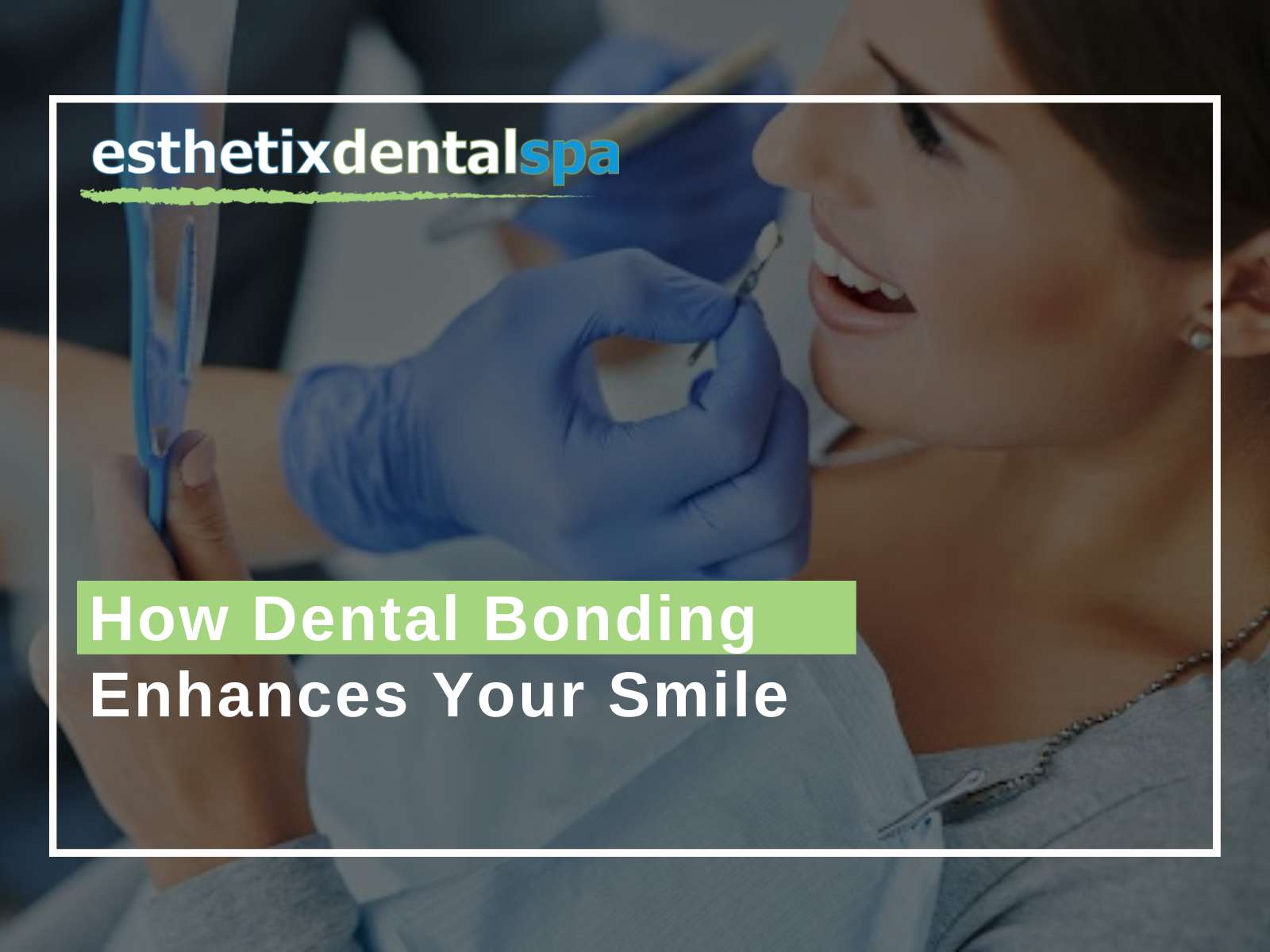 How Dental Bonding Enhances Your Smile