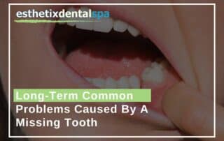 Long-Term Common Problems Caused By A Missing Tooth