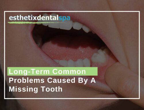 Long-Term Common Problems Caused By A Missing Tooth