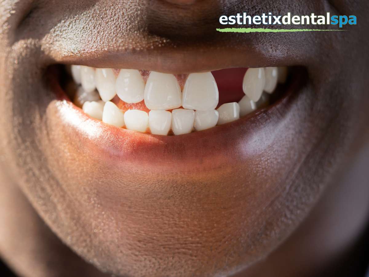 Male patient with a missing tooth