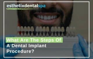 What Are The Steps Of A Dental Implant Procedure