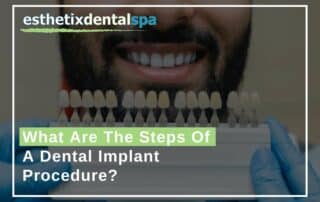 What Are The Steps Of A Dental Implant Procedure