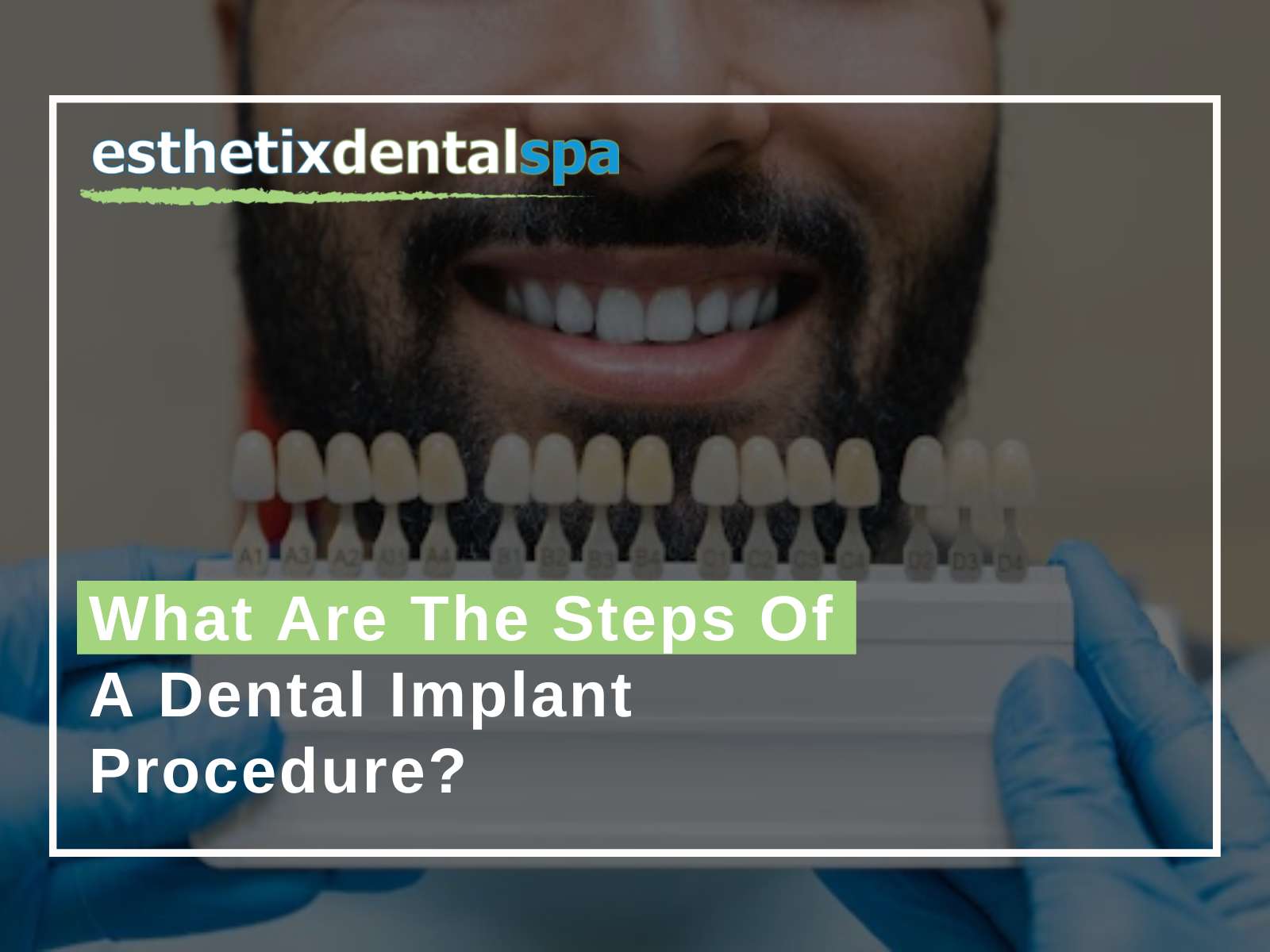 What Are The Steps Of A Dental Implant Procedure