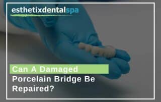 Can A Damaged Porcelain Bridge Be Repaired