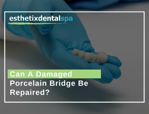 Can A Damaged Porcelain Bridge Be Repaired?