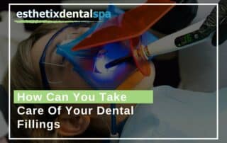 How Can You Take Care Of Your Dental Fillings