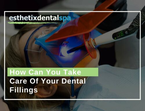 How Can You Take Care Of Your Dental Fillings