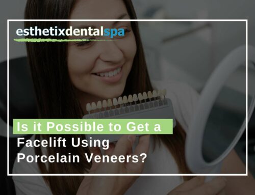 Is it Possible To Get a Facelift Using Porcelain Veneers?