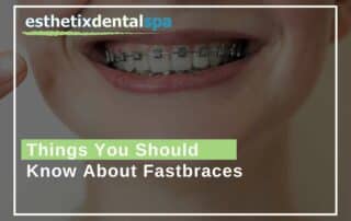 Things You Should Know About Fastbraces AZ