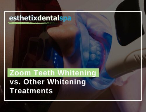 Zoom Teeth Whitening vs. Other Whitening Treatments