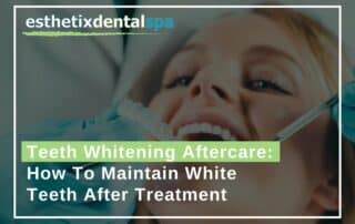 Teeth Whitening Aftercare How To Maintain White Teeth After Treatment