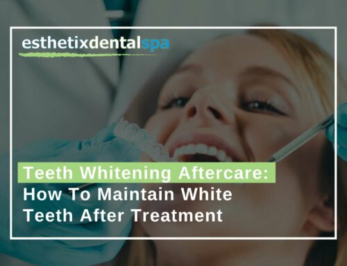 Teeth Whitening Aftercare: How To Maintain White Teeth After Treatment