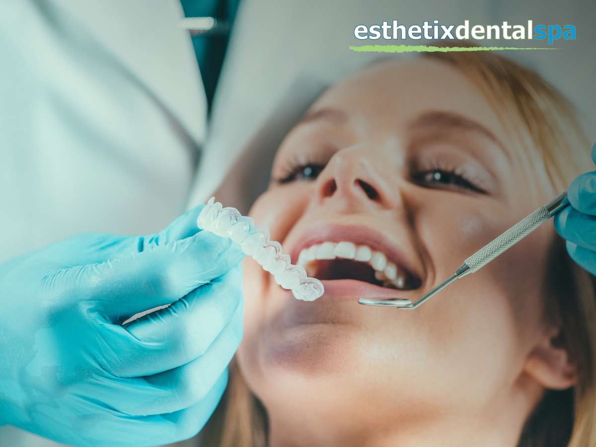 Teeth Whitening