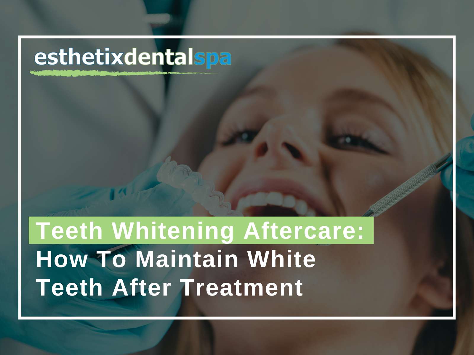 Teeth Whitening Aftercare How To Maintain White Teeth After Treatment