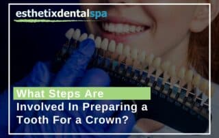 What Steps Are Involved In Preparing a Tooth For a Crown?