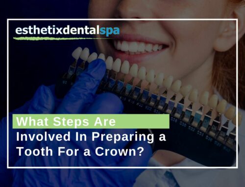 What Steps Are Involved In Preparing a Tooth For a Crown?