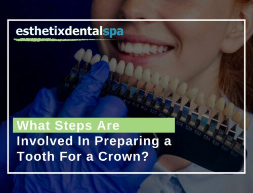 What Steps Are Involved In Preparing a Tooth For a Crown?