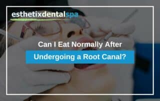 Can I Eat Normally After Undergoing a Root Canal