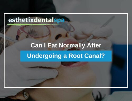 Can I Eat Normally After Undergoing a Root Canal?